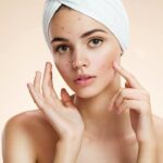 Treating Adult Acne: Professional Dermatology Solutions
