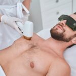  How to Prepare Your Skin for Laser Treatments