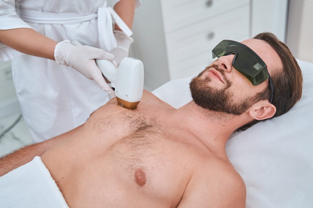  How to Prepare Your Skin for Laser Treatments