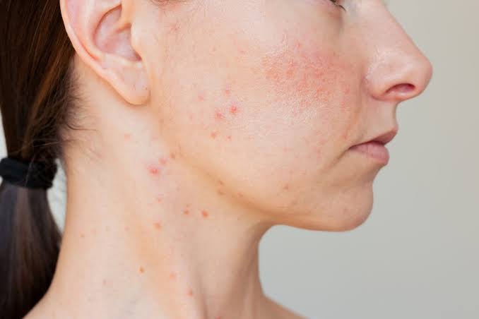 Top Skin Concerns Treated with Modern Dermatology